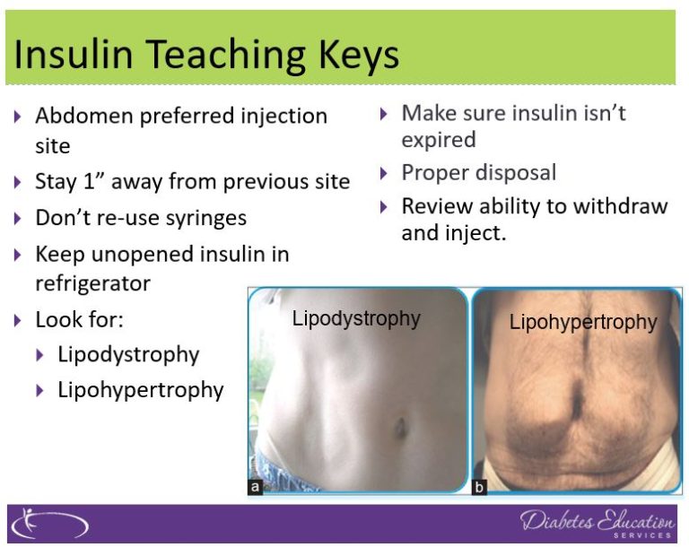 rationale-of-the-week-abdominal-lumps-and-insulin-injections